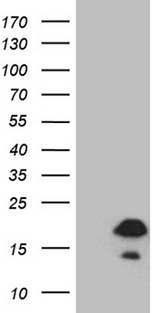 FLJ33360 Antibody - HEK293T cells were transfected with the pCMV6-ENTRY control. (Left lane) or pCMV6-ENTRY FLJ33360. (Right lane) cDNA for 48 hrs and lysed