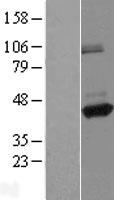 FLJ43980 Protein - Western validation with an anti-DDK antibody * L: Control HEK293 lysate R: Over-expression lysate