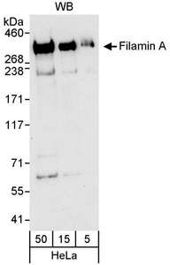 FLNA / Filamin A Antibody - Detection of Human Filamin A by Western Blot. Samples: Whole cell lysate (5, 15 and 50 ug for WB) from HeLa cells. Antibody: Affinity purified rabbit anti-Filamin A antibody used for WB at 0.04 ug/ml. Detection: Chemiluminescence with an exposure time of 30 seconds.