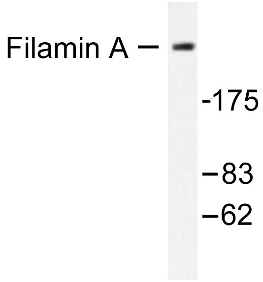 FLNA / Filamin A Antibody - Western blot of Filamin A (R2146) pAb in extracts from 293 cells treated with EGF 200ng/ml 5'.