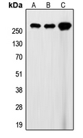 FLNA / Filamin A Antibody - Western blot analysis of Filamin A expression in HEK293T (A); SP2/0 (B); rat heart (C) whole cell lysates.