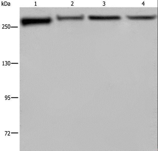 FLNA / Filamin A Antibody - Western blot analysis of PC3, HeLa, NIH/3T3 and HUVEB cell, using FLNA Polyclonal Antibody at dilution of 1:800.
