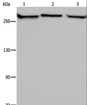 FLNA / Filamin A Antibody - Western blot analysis of PC3, NIH/3T3 and HUVEB cell, using FLNA Polyclonal Antibody at dilution of 1:1100.