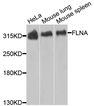 FLNA / Filamin A Antibody - Western blot analysis of extracts of various cells.