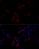 FLNA / Filamin A Antibody - Immunofluorescence analysis of HeLa cells using FLNA antibody at dilution of 1:100 (40x lens). Blue: DAPI for nuclear staining.