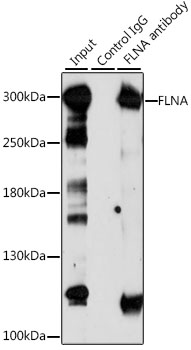 FLNA / Filamin A Antibody - Immunoprecipitation analysis of 200ug extracts of Jurkat cells, using 3 ug FLNA antibody. Western blot was performed from the immunoprecipitate using FLNA antibody at a dilition of 1:1000.