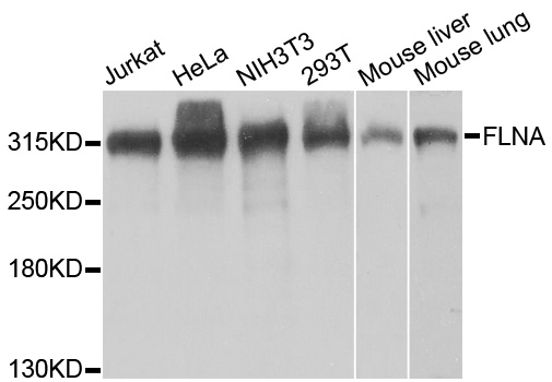 FLNA / Filamin A Antibody - Western blot analysis of extracts of various cell lines, using FLNA antibody at 1:1000 dilution. The secondary antibody used was an HRP Goat Anti-Rabbit IgG (H+L) at 1:10000 dilution. Lysates were loaded 25ug per lane and 3% nonfat dry milk in TBST was used for blocking. An ECL Kit was used for detection and the exposure time was 1s.