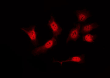 FLNA / Filamin A Antibody - Staining 293 cells by IF/ICC. The samples were fixed with PFA and permeabilized in 0.1% Triton X-100, then blocked in 10% serum for 45 min at 25°C. The primary antibody was diluted at 1:200 and incubated with the sample for 1 hour at 37°C. An Alexa Fluor 594 conjugated goat anti-rabbit IgG (H+L) Ab, diluted at 1/600, was used as the secondary antibody.