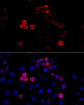 FLNA / Filamin A Antibody - Immunofluorescence analysis of HeLa cells using FLNA Polyclonal Antibody at dilution of 1:100 (40x lens).Blue: DAPI for nuclear staining.