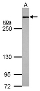FLNA / Filamin A Antibody - Sample (30 ug of whole cell lysate) A: A431 5% SDS PAGE FLNA / FMD antibody diluted at 1:1000