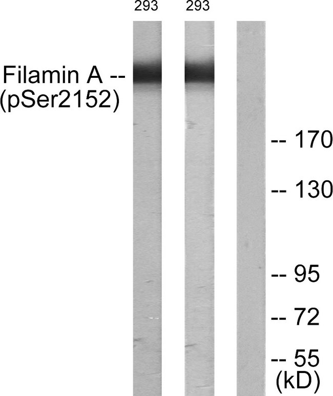 FLNA / Filamin A Antibody - Western blot analysis of lysates from 293 cells treated with EGF 200ng/ml 5', using Filamin A (Phospho-Ser2152) Antibody. The lane on the right is blocked with the phospho peptide.