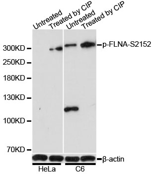 FLNA / Filamin A Antibody - Western blot analysis of extracts of HeLa and C6 cells, using Phospho-FLNA-S2152 antibody at 1:1000 dilution. Hela cell lysate were treated by CIP (20ul CIP for each 400ul cell lysate) at 37â„ƒ for 1 hour .C6 cell lysate were treated by CIP (20ul CIP for each 400ul cell lysate) at 37â„ƒ for 1 hour. The secondary antibody used was an HRP Goat Anti-Rabbit IgG (H+L) at 1:10000 dilution. Lysates were loaded 25ug per lane and 3% nonfat dry milk in TBST was used for blocking. Blocking buffer: 3% BSA.An ECL Kit was used for detection and the exposure time was 30s.