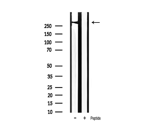 FLNA / Filamin A Antibody - Western blot analysis of Filamin A phosphorylation expression in rat spleen tissue lysates. The lane on the right is treated with the antigen-specific peptide.