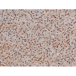 FLNA / Filamin A Antibody - 1:200 staining human kidney tissue by IHC-P. The tissue was formaldehyde fixed and a heat mediated antigen retrieval step in citrate buffer was performed. The tissue was then blocked and incubated with the antibody for 1.5 hours at 22°C. An HRP conjugated goat anti-rabbit antibody was used as the secondary.
