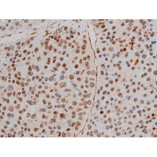 FLNA / Filamin A Antibody - 1:200 staining human tonsil tissue by IHC-P. The tissue was formaldehyde fixed and a heat mediated antigen retrieval step in citrate buffer was performed. The tissue was then blocked and incubated with the antibody for 1.5 hours at 22°C. An HRP conjugated goat anti-rabbit antibody was used as the secondary.