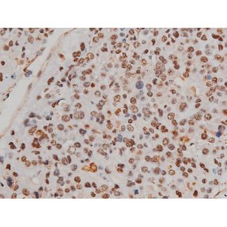 FLNA / Filamin A Antibody - 1:200 staining human tonsil tissue by IHC-P. The tissue was formaldehyde fixed and a heat mediated antigen retrieval step in citrate buffer was performed. The tissue was then blocked and incubated with the antibody for 1.5 hours at 22°C. An HRP conjugated goat anti-rabbit antibody was used as the secondary.