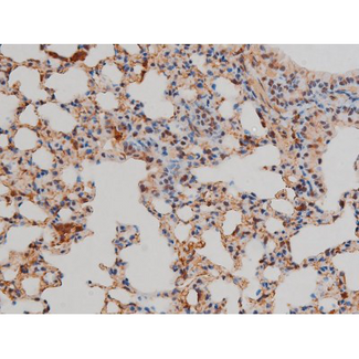 FLNA / Filamin A Antibody - 1:200 staining mouse lung tissue by IHC-P. The tissue was formaldehyde fixed and a heat mediated antigen retrieval step in citrate buffer was performed. The tissue was then blocked and incubated with the antibody for 1.5 hours at 22°C. An HRP conjugated goat anti-rabbit antibody was used as the secondary.