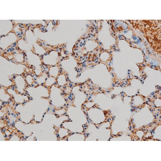 FLNA / Filamin A Antibody - 1:200 staining mouse lung tissue by IHC-P. The tissue was formaldehyde fixed and a heat mediated antigen retrieval step in citrate buffer was performed. The tissue was then blocked and incubated with the antibody for 1.5 hours at 22°C. An HRP conjugated goat anti-rabbit antibody was used as the secondary.