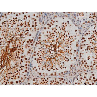 FLNA / Filamin A Antibody - 1:200 staining mouse testis tissue by IHC-P. The tissue was formaldehyde fixed and a heat mediated antigen retrieval step in citrate buffer was performed. The tissue was then blocked and incubated with the antibody for 1.5 hours at 22°C. An HRP conjugated goat anti-rabbit antibody was used as the secondary.