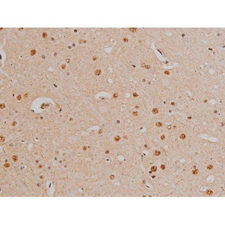 FLNA / Filamin A Antibody - 1:200 staining rat brain tissue by IHC-P. The tissue was formaldehyde fixed and a heat mediated antigen retrieval step in citrate buffer was performed. The tissue was then blocked and incubated with the antibody for 1.5 hours at 22°C. An HRP conjugated goat anti-rabbit antibody was used as the secondary.