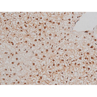FLNA / Filamin A Antibody - 1:200 staining rat liver tissue by IHC-P. The tissue was formaldehyde fixed and a heat mediated antigen retrieval step in citrate buffer was performed. The tissue was then blocked and incubated with the antibody for 1.5 hours at 22°C. An HRP conjugated goat anti-rabbit antibody was used as the secondary.