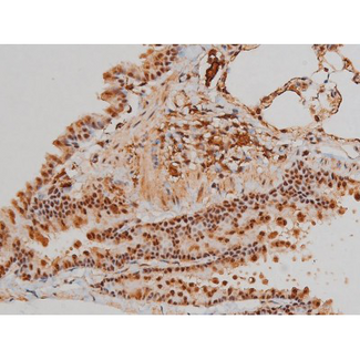 FLNA / Filamin A Antibody - 1:200 staining rat lung tissue by IHC-P. The tissue was formaldehyde fixed and a heat mediated antigen retrieval step in citrate buffer was performed. The tissue was then blocked and incubated with the antibody for 1.5 hours at 22°C. An HRP conjugated goat anti-rabbit antibody was used as the secondary.