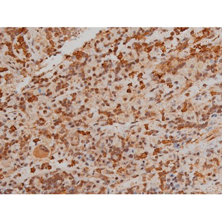 FLNA / Filamin A Antibody - 1:200 staining rat spleen tissue by IHC-P. The tissue was formaldehyde fixed and a heat mediated antigen retrieval step in citrate buffer was performed. The tissue was then blocked and incubated with the antibody for 1.5 hours at 22°C. An HRP conjugated goat anti-rabbit antibody was used as the secondary.