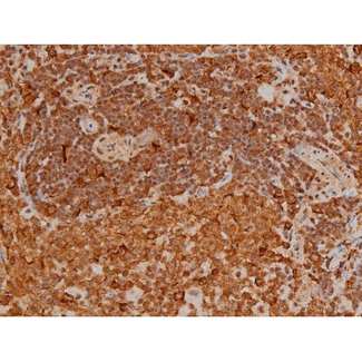 FLNA / Filamin A Antibody - 1:200 staining rat spleen tissue by IHC-P. The tissue was formaldehyde fixed and a heat mediated antigen retrieval step in citrate buffer was performed. The tissue was then blocked and incubated with the antibody for 1.5 hours at 22°C. An HRP conjugated goat anti-rabbit antibody was used as the secondary.