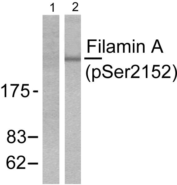 FLNA / Filamin A Antibody - Western blot analysis of extracts from 293 cells treated with EGF (200ng/ml, 5mins), using Filamin A (phospho-Ser2152) antibody.