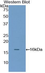 FLNB / TAP Antibody - Western blot of recombinant FLNB / TAP.  This image was taken for the unconjugated form of this product. Other forms have not been tested.