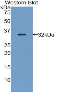 FLNB / TAP Antibody - Western Blot; Sample: Recombinant protein.