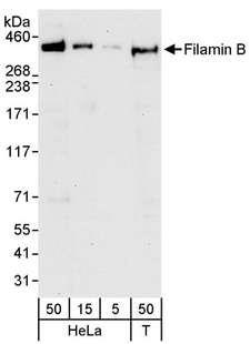 FLNB / TAP Antibody - Detection of Human Filamin B by Western Blot. Samples: Whole cell lysate from HeLa (5, 15 and 50 ug) and 293T (T; 50 ug) cells. Antibodies: Affinity purified rabbit anti-Filamin B antibody used for WB at 0.04 ug/ml. Detection: Chemiluminescence with an exposure time of 30 seconds.