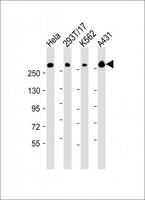 FLNB / TAP Antibody - All lanes: Anti-FLNB Antibody (N-Term) at 1:2000 dilution. Lane 1: HeLa whole cell lysate. Lane 2: 293T/17 whole cell lysate. Lane 3: K562 whole cell lysate. Lane 4: A431 whole cell lysate Lysates/proteins at 20 ug per lane. Secondary Goat Anti-Rabbit IgG, (H+L), Peroxidase conjugated at 1:10000 dilution. Predicted band size: 278 kDa. Blocking/Dilution buffer: 5% NFDM/TBST.