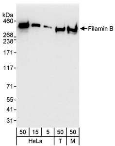 FLNB / TAP Antibody - Detection of Human and Mouse Filamin B by Western Blot. Samples: Whole cell lysate from HeLa (5, 15 and 50 ug), 293T (T; 50 ug), and mouse NIH3T3 (M; 50 ug) cells. Antibodies: Affinity purified rabbit anti-Filamin B antibody used for WB at 0.04 ug/ml. Detection: Chemiluminescence with an exposure time of 3 seconds.