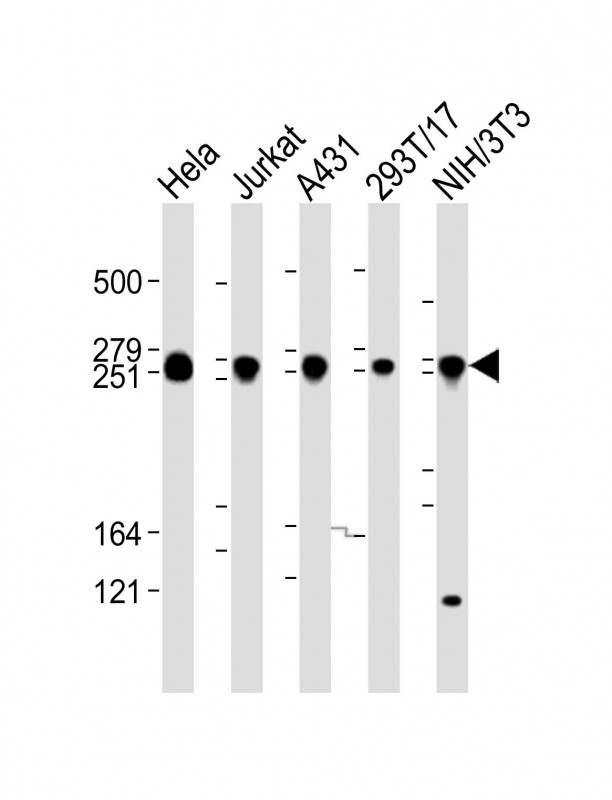 FLNB / TAP Antibody - All lanes: Anti-FLNB Antibody (N-Term) at 1:2000 dilution. Lane 1: HeLa whole cell lysate. Lane 2: Jurkat whole cell lysate. Lane 3: A431 whole cell lysate. Lane 4: 293T/17 whole cell lysate. Lane 5: NIH/3T3 whole cell lysate Lysates/proteins at 20 ug per lane. Secondary Goat Anti-Rabbit IgG, (H+L), Peroxidase conjugated at 1:10000 dilution. Predicted band size: 278 kDa. Blocking/Dilution buffer: 5% NFDM/TBST.