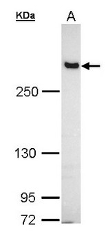 FLNB / TAP Antibody - Sample (30 ug of whole cell lysate). A: A431. 5% SDS PAGE. FLNB antibody diluted at 1:1000. 