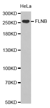 FLNB / TAP Antibody - Western blot analysis of extracts of HeLa cells.