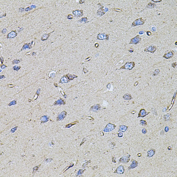 FLNB / TAP Antibody - Immunohistochemistry of paraffin-embedded rat brain tissue.