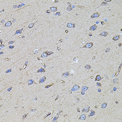 FLNB / TAP Antibody - Immunohistochemistry of paraffin-embedded rat brain tissue.