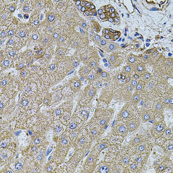 FLNB / TAP Antibody - Immunohistochemistry of paraffin-embedded human liver injury tissue.
