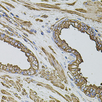 FLNB / TAP Antibody - Immunohistochemistry of paraffin-embedded human prostate tissue.
