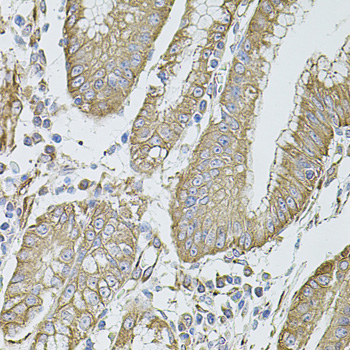 FLNB / TAP Antibody - Immunohistochemistry of paraffin-embedded human stomach tissue.