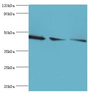 FLOT2 / Flotillin 2 Antibody - Western blot. All lanes: Flotillin-2 antibody at 4 ug/ml. Lane 1: A549 whole cell lysate. Lane 2: HeLa whole cell lysate. Lane 3: rat brain tissue. Secondary antibody: Goat polyclonal to rabbit at 1:10000 dilution. Predicted band size: 47 kDa. Observed band size: 47 kDa Immunohistochemistry.