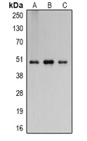 FLOT2 / Flotillin 2 Antibody - Western blot analysis of Flotillin 2 expression in A431 (A); mouse brain (B); rat brain (C) whole cell lysates.