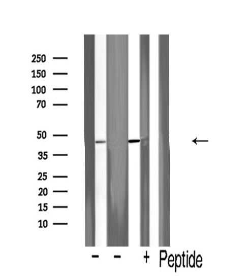 FLOT2 / Flotillin 2 Antibody - Western blot analysis of ESA expression in various lysates
