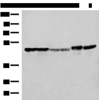 FLOT2 / Flotillin 2 Antibody - Western blot analysis of Hela A375 Human fetal liver tissue Human fetal brain tissue HepG2 cell and Mouse brain tissue lysates  using FLOT2 Polyclonal Antibody at dilution of 1:350
