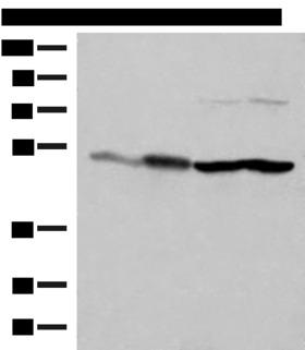 FLOT2 / Flotillin 2 Antibody - Western blot analysis of Mouse brain tissue HepG2 A375 Hela cell lysates  using FLOT2 Polyclonal Antibody at dilution of 1:350
