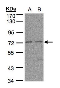 FLRT1 Antibody - Sample (30g whole cell lysate). A: H1299, B: HeLa S3. 7.5% SDS PAGE. FLRT1 antibody diluted at 1:1000