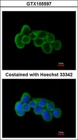 FLRT1 Antibody - Immunofluorescence of methanol-fixed A431 using FLRT1 antibody at 1:200 dilution.
