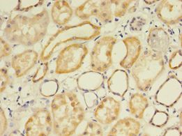 FLRT1 Antibody - Immunohistochemistry of paraffin-embedded human kidney using antibody at 1:100 dilution.  This image was taken for the unconjugated form of this product. Other forms have not been tested.